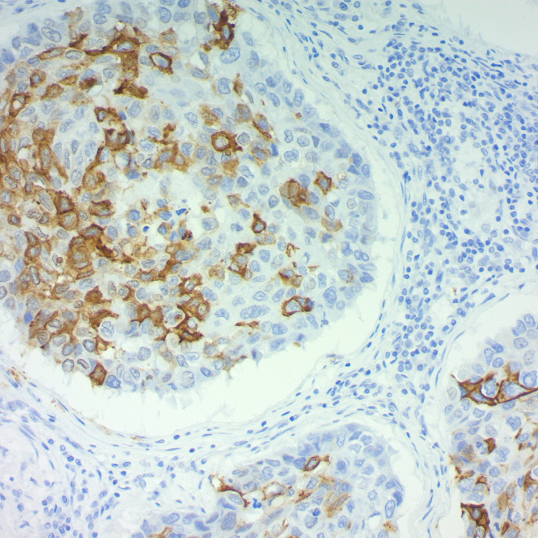 CA19-9; Clone 121SLE (Ready-To-Use)